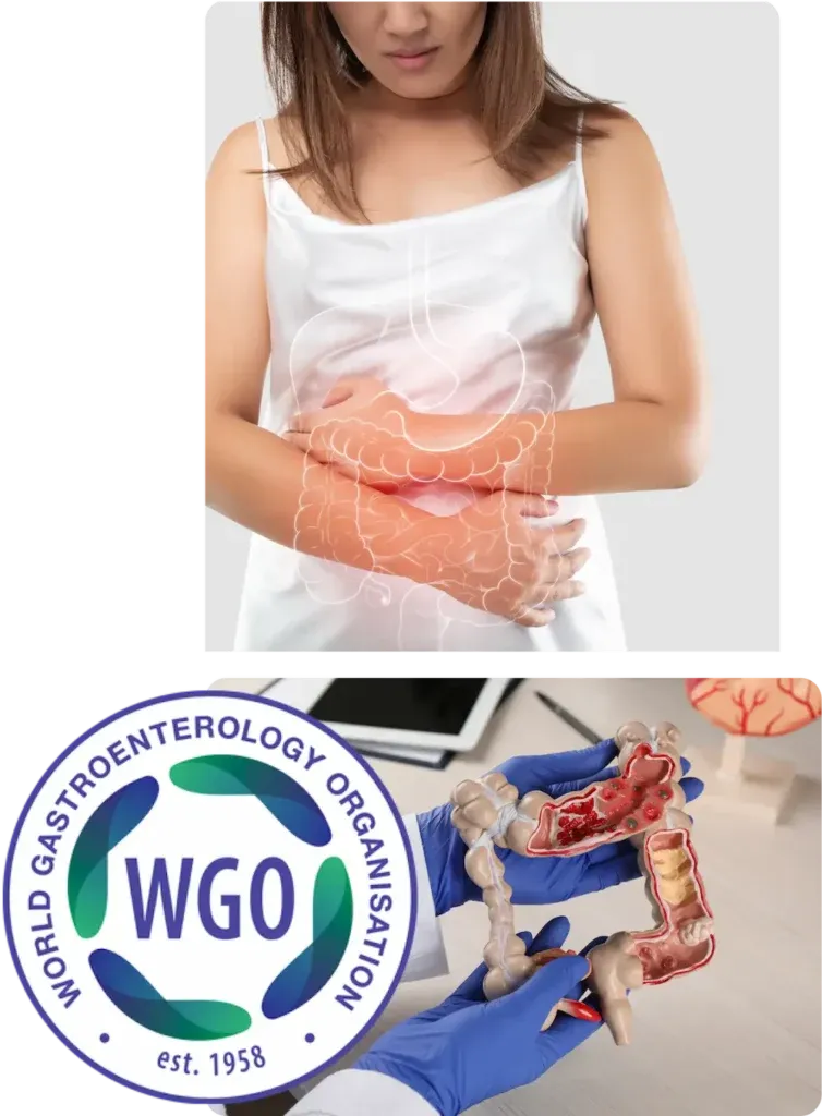 probioticos colon irritable